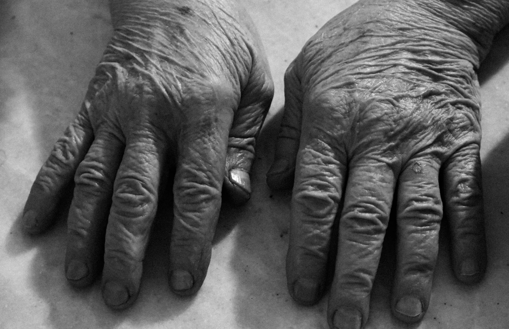Des mains âgées et ridées, posées l'une sur l'autre